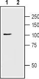 Western blot analysis of rat brain lysate: