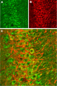 Expression of NMDA receptor 2B in rat hippocampus