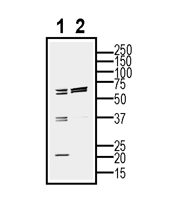 Western blot analysis of mouse BV-2 cell line lysate (lane 1) and BV2-derived purified exosomes (lane 2):
