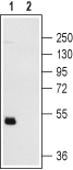 Western blot analysis of human platelets: