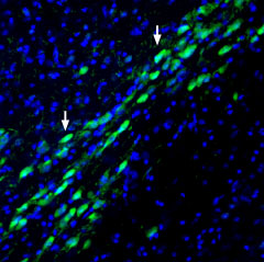 Expression of NHE1 in mouse substantia nigra pars compacta
