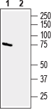 Western blot analysis of mouse brain membranes: