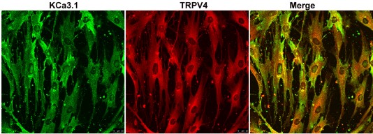 Multiplex staining of TRPV4 and K Ca 3.1 in human BSM cells.