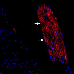 Expression of Periaxin in rat spinal dorsal root entry zone