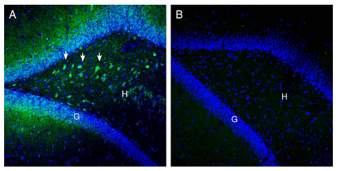Expression of SLC25A12 in rat hippocampus.