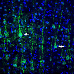 Expression of VGLUT1 in rat cortex