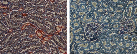 Expression of KCNJ1 in rat kidney