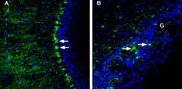 Expression of LRRC8A in mouse cerebellum and olfactory bulb