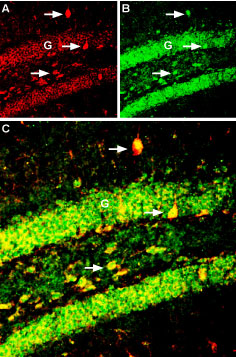 Multiplex staining of K ir 6.2 and BDNF in mouse hippocampus.