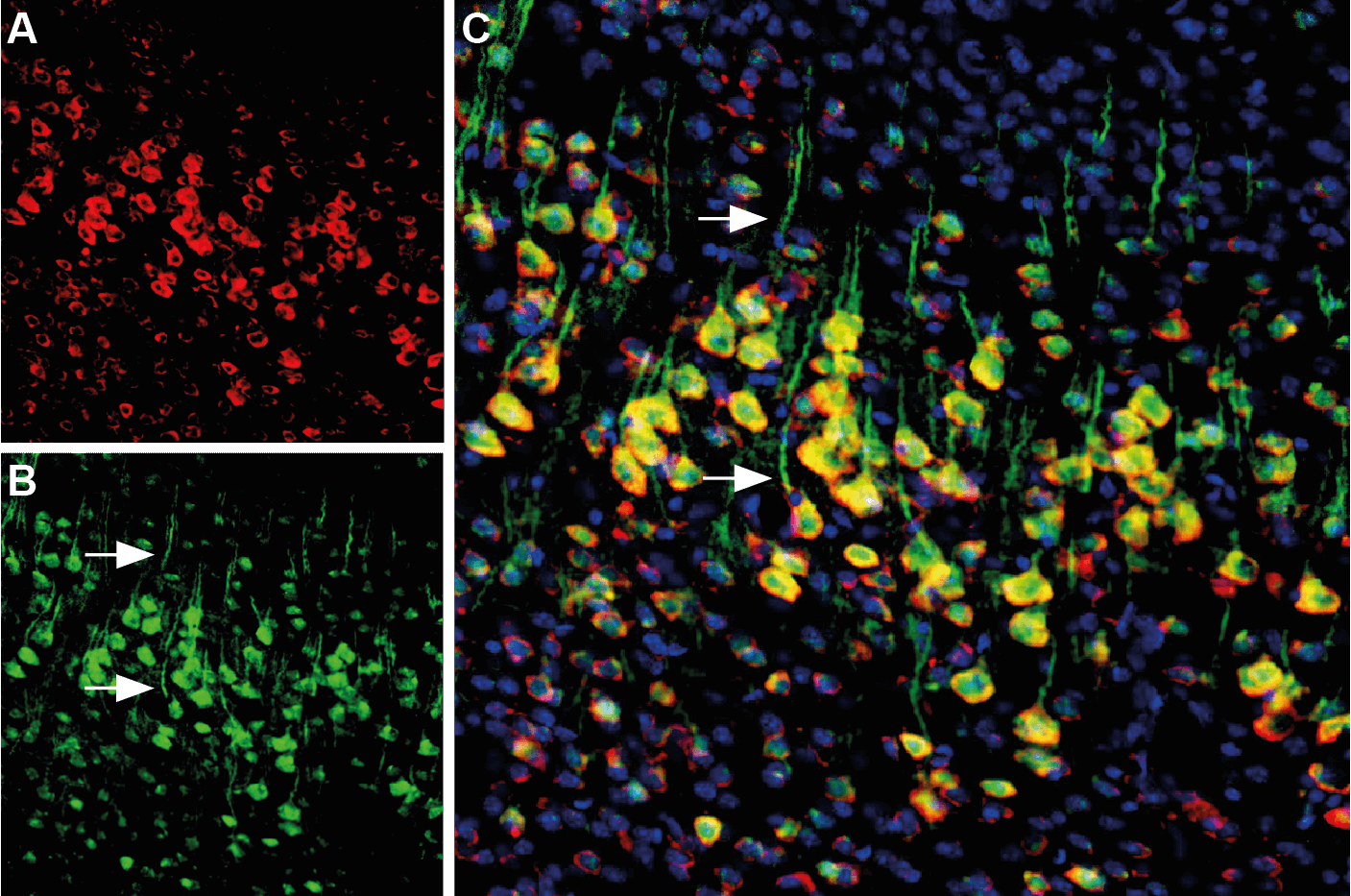 Multiplex staining of Calnexin and Presenilin-1 in mouse cortex