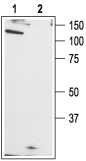 Western blot analysis of rat brain membranes: