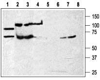 Western blot analysis of rat brain membranes (lanes 1 and 5) and huma n K562 chronic myelogenous leukemia cell line (lanes 2 and 6) and Mouse W</s