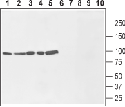Western blot analysis of rat brain membranes (lanes 1 and 6), mouse brain lysate (lanes 2 and 7), human MCF-7 breast adenocarcinoma cells (lanes 3 and 8), human U-87 MG glioblastoma cells (lanes 4 and 9) and human THP-1 acute monocytic leukemia ce