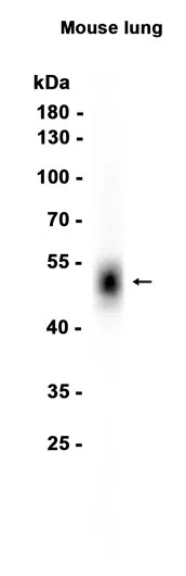 AMRe87062