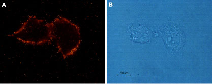 Expression of AGTR1 in rat C6 glioma cells