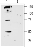 Western blot analysis of rat striatum membranes: