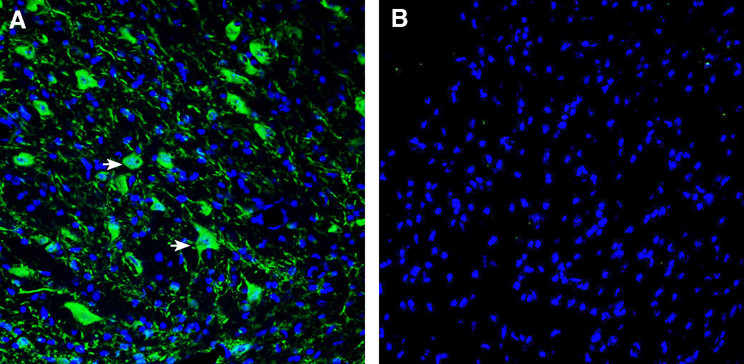 Expression of L1CAM in mouse deep cerebellar nuclei.