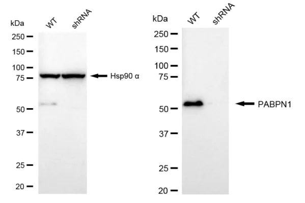 KVAb00997
