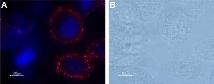 Expression of PAR-1 in human prostate PC-3 cell line