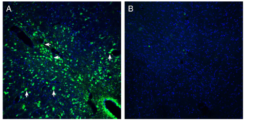 Expression of Presenilin-2 in mouse midbrain