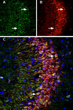 Multiplex staining of LINGO-1 and p75 NTR in rat hippocampus