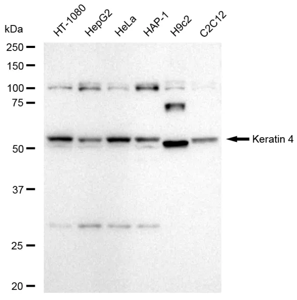 KVAb01049