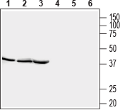 Western blot analysis of rat brain lysate (lanes 1 and 4), mouse brain lysate (lanes 2 and 5) and rat skeletal muscle lysate (lanes 3 and 6):