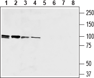 Western blot analysis of human promyelocytic leukemia (HL-60) (lanes 1 and 5), human Burkitt's lymphoma (Raji) B (lanes 2 and 6), mouse macrophage J774 (lanes 3 and 7) and rat basophilic leukemia (RBL) (lanes 4 and 8) cell lysates: