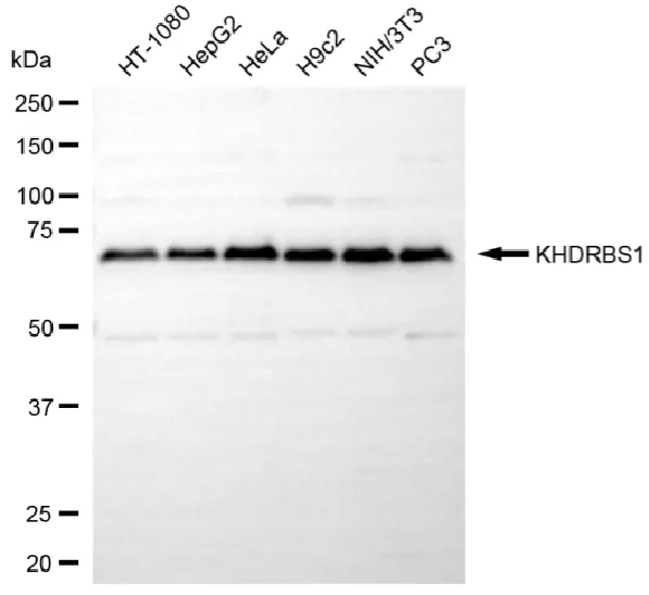 KVAb01301