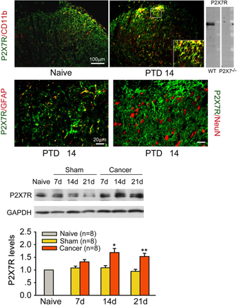 Expression and upregulation of microglial P2X7 receptor in cancer.