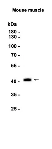 AMRe86369