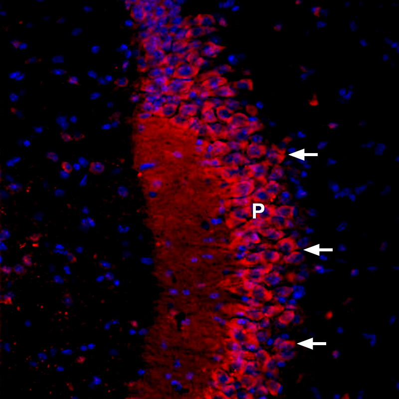 Expression of Ca V β2 in rat brain