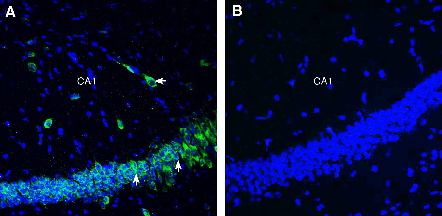 Expression of SLC3A2 (CD98) in mouse hippocampus