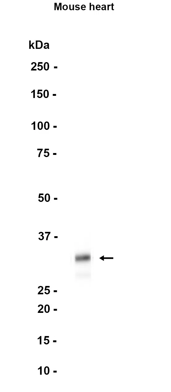 AMRe87650