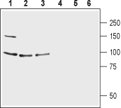 Western blot analysis of human CCF-STTG1 astrocytoma cell lysate (lanes 1 and 4), mouse brain lysate (lanes 2 and 5) and rat brain lysate (lines 3 and 6):