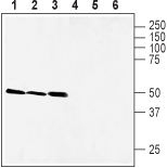 Western blot analysis of rat brain (lanes 1 and 4), mouse brain (lanes 2 and 5) and rat stomach (lanes 3 and 6) lysates: