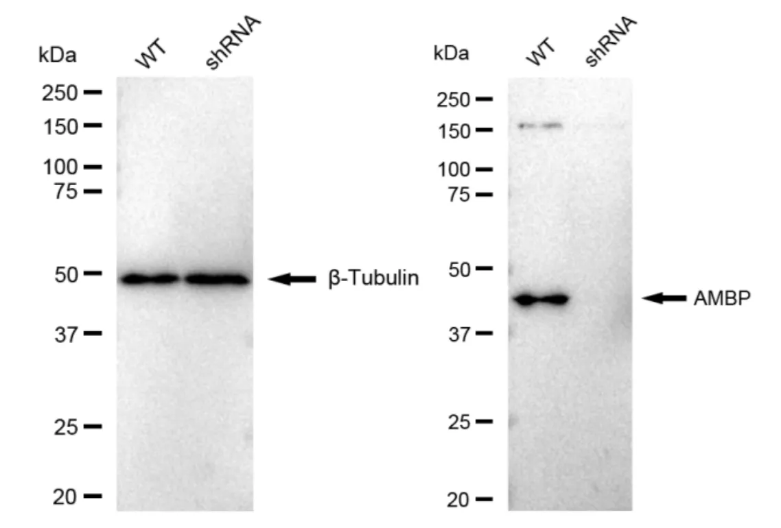 KVAb01420