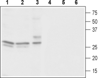 Western blot analysis of rat brain (lanes 1 and 4), mouse brain (lanes 2 and 5) and human neuroblastoma (SH-SY5Y) cells (lanes 3 and 6):