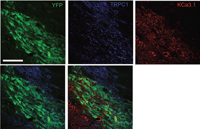 Multiplex staining of K Ca 3.1 and TRPC1 in mouse brain.
