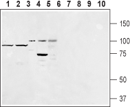 Western blot analysis of rat fat (lanes 1 and 6), mouse fat (lanes 2 and 7), human Burkitt's lymphoma (Raji) (lanes 3 and 8), rat basophilic leukemia (RBL) (lanes 4 and 9) and human promyelocytic leukemia (HL-60) (lanes 5 and 10) lysates: