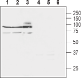 Western blot analysis of rat brain lysates (lanes 1 and 4), mouse brain lysates (lanes 2 and 5) and human SH-SY5Y neuroblastoma cell lysates (lanes 3 and 6):