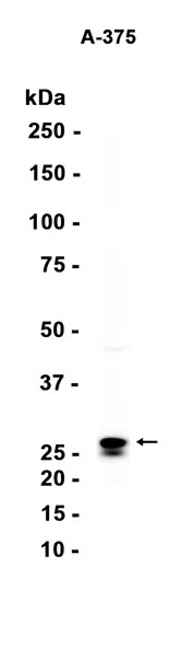 AMRe87148