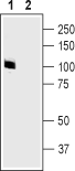 Western blot analysis of rat brain membranes: