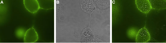 Expression of p75 NTR in human A875 melanoma cells