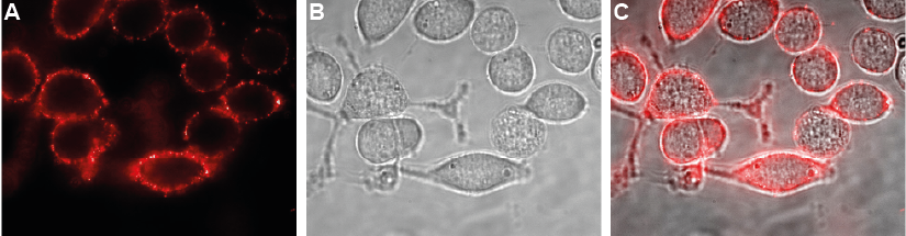 Expression of K ir 4.1 in human U-87 MG cells