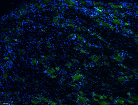 Expression of TRPV1 in rat DRG
