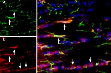 Multiplex staining of IBA1/AIF1 and P2X7 in rat brain.