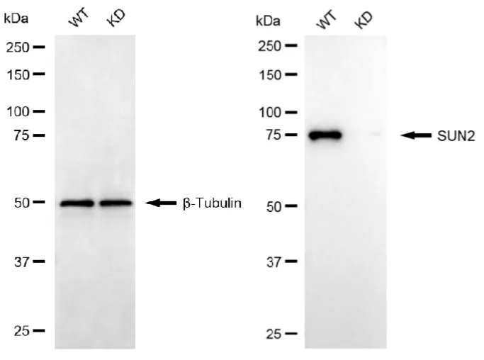 KVAb01305