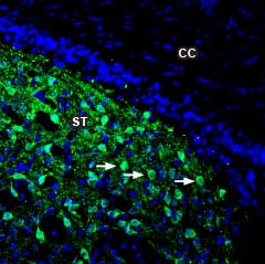 Expression of DARPP32 in rat striatum