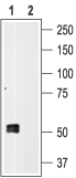 Western blot analysis of human platelet lysates: